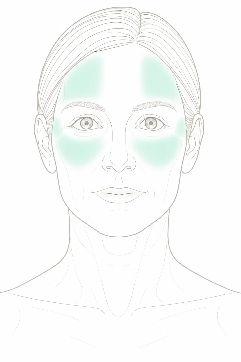 HIFU 1,5 mm Behandlungsareale frontal