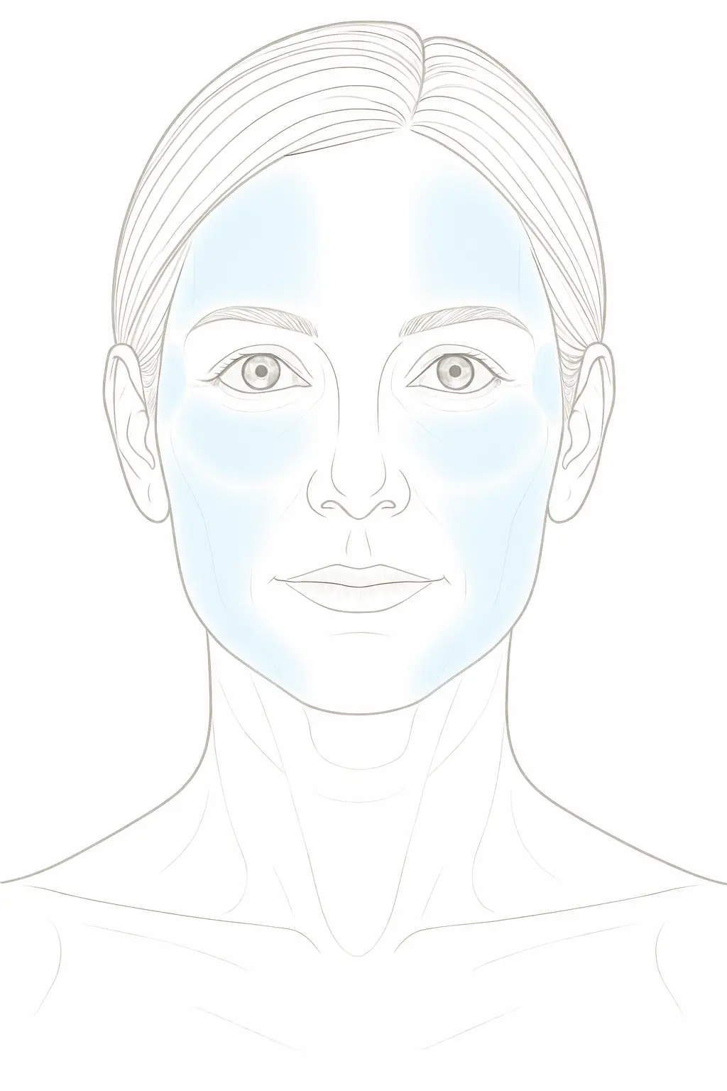 HIFU 3,0 mm Behandlungsareale frontal