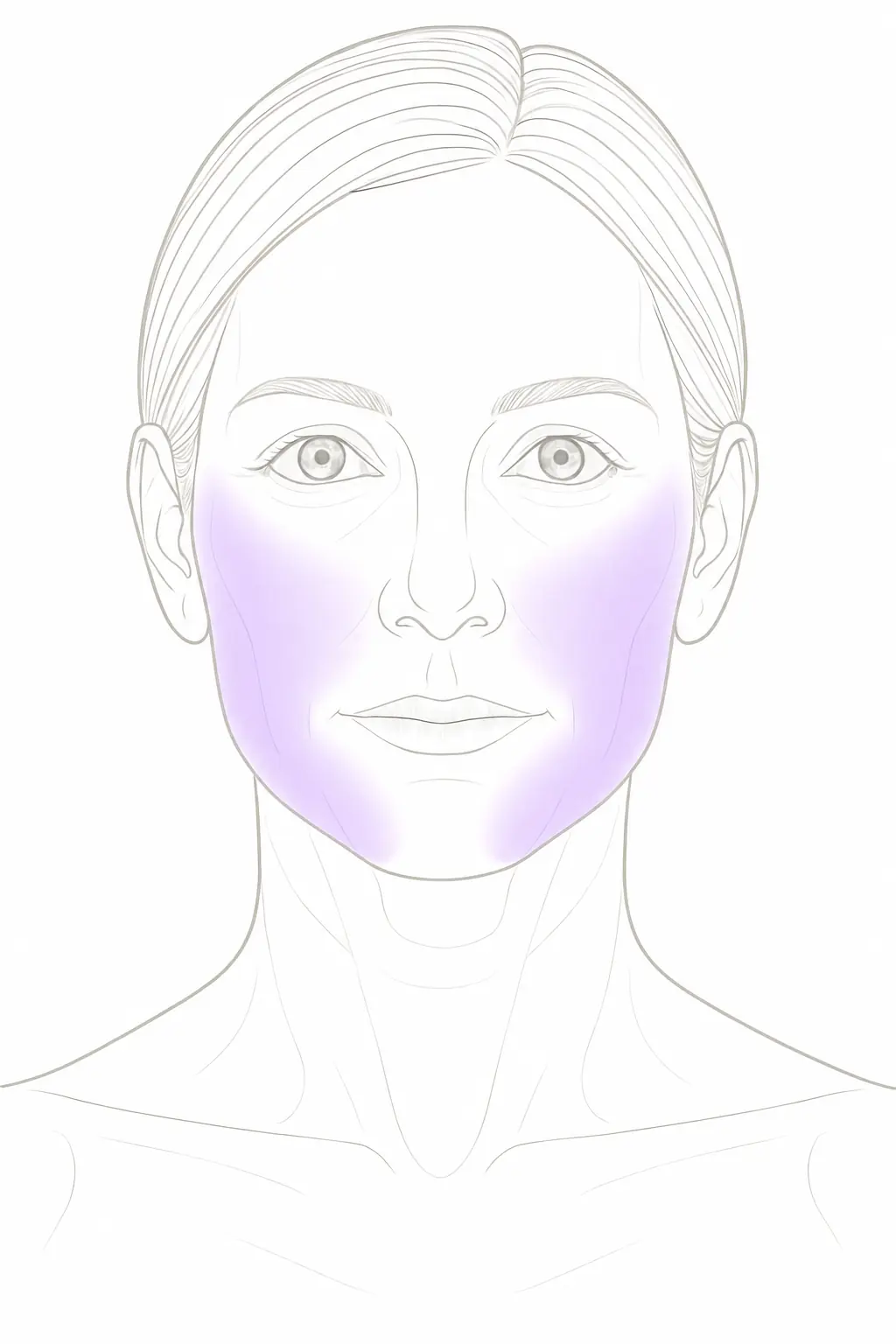 HIFU 4,5 mm Behandlungsareale frontal